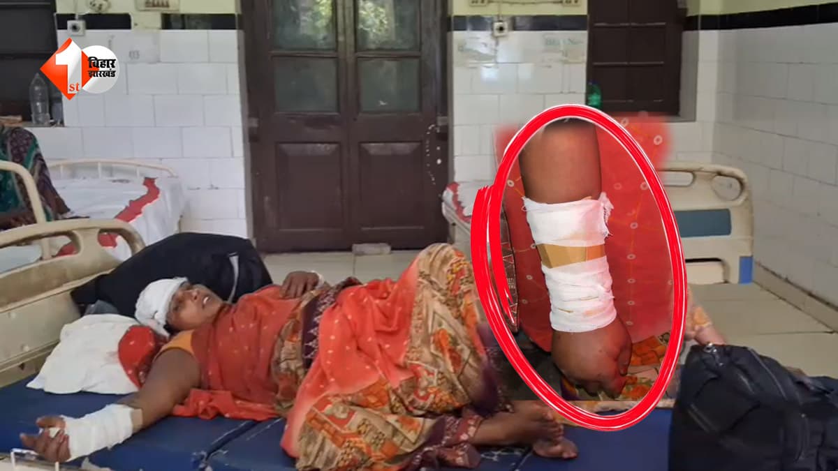 हद हो गई! बिहार के अस्पताल में फ्रैक्चर हाथ पर प्लास्टर की जगह बांध दिया कार्टून, तस्वीर देख रह जाएंगे दंग