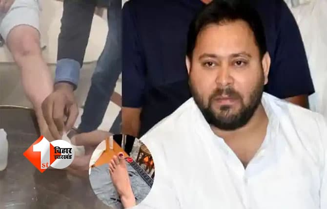Bihar Assembly : तेजस्वी यादव के साथ हादसा, बिहार विधानमंडल के बजट सत्र में नहीं होंगे शामिल; जानिए क्या है पूरी खबर