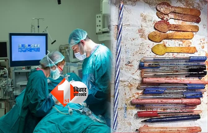 सीने में दर्द के बाद अस्पताल पहुंची महिला, सर्जरी में पेट से निकले 14 पेन, 5 चम्मच और मोमबत्ती